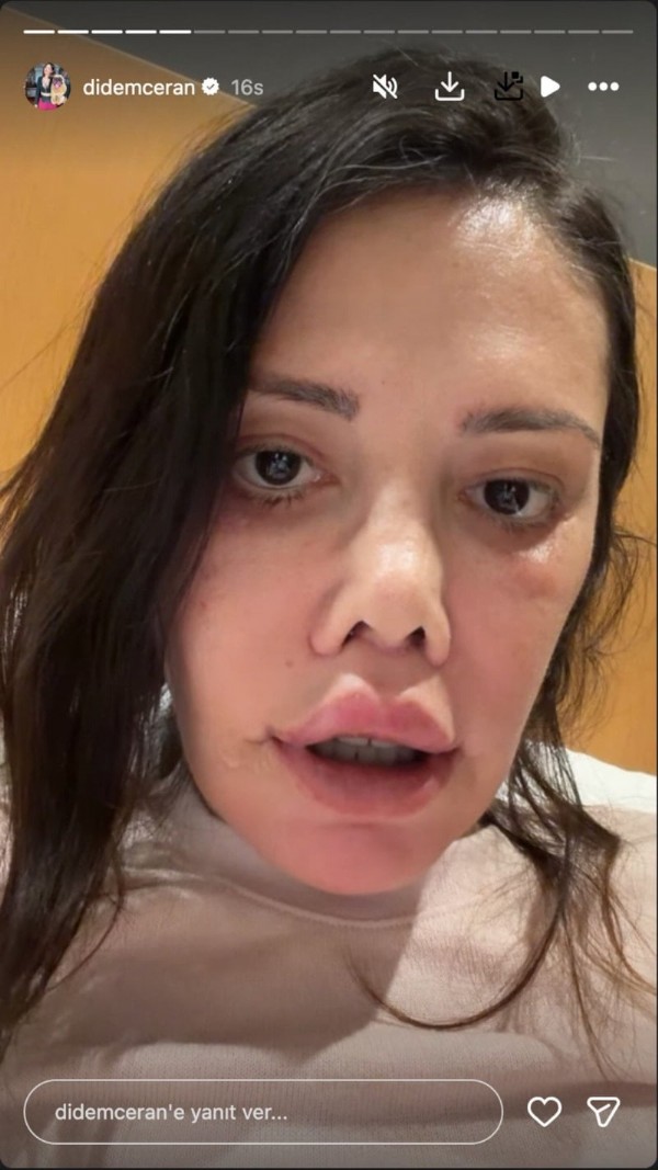 Didem Ceran 1. Ayını Anlattı