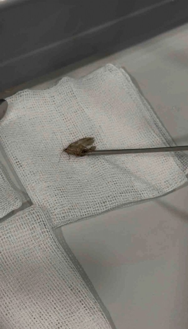 Kulağından Canlı Olarak Çıkarıldı! Doktor Bile Şoke Oldu